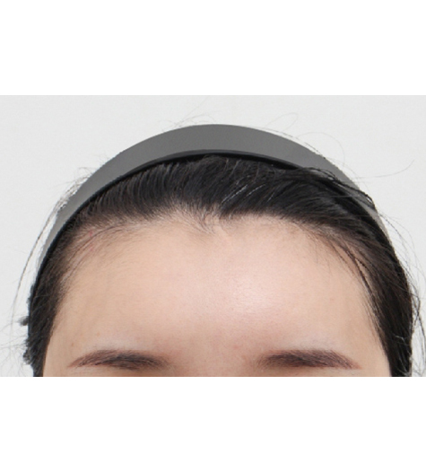 Before Image 3
