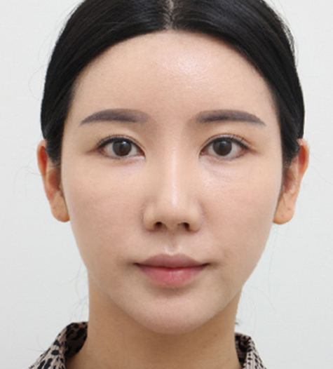 Before Image
