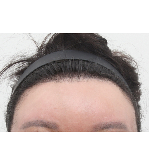 Before Image 3