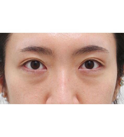 Before Image
