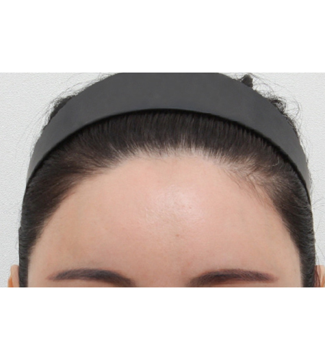 Before Image 3