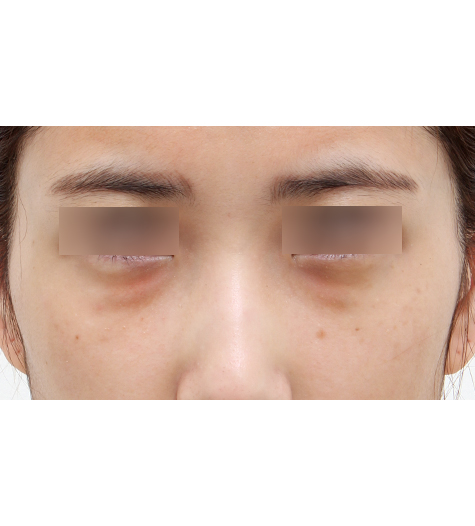 Before Image