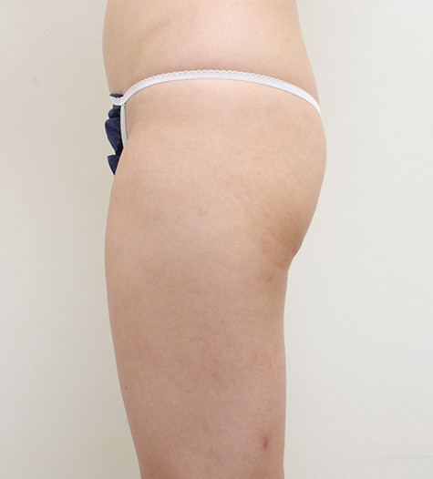 Before Image 3