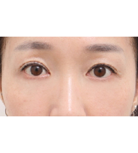 Before Image