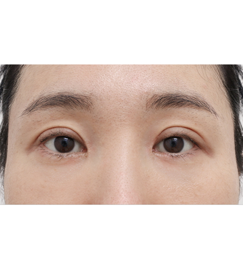 Before Image