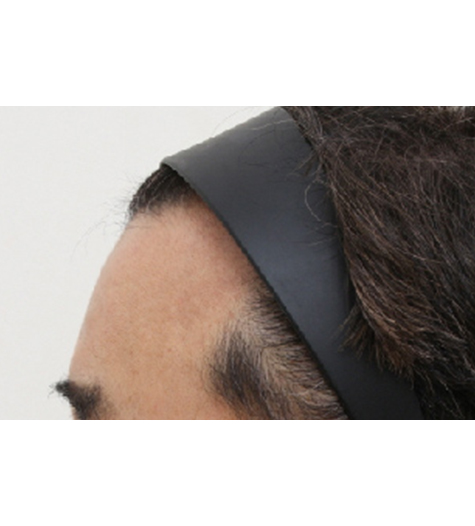 Before Image 4