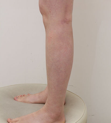 Before Image 4
