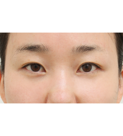 Before Image