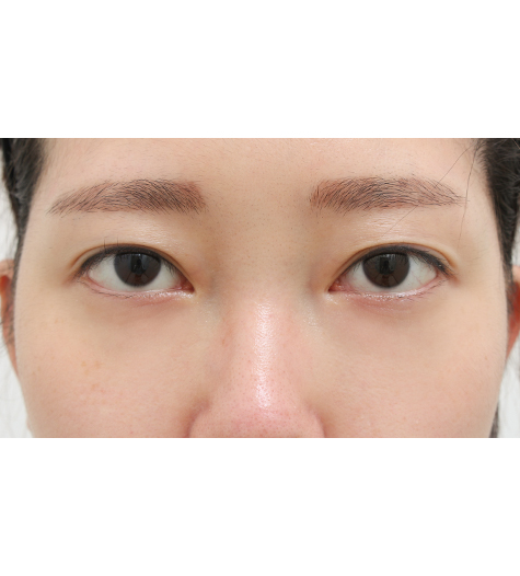 Before Image