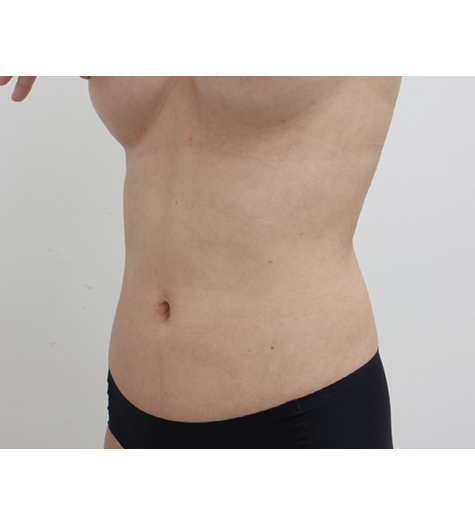 Before Image 3