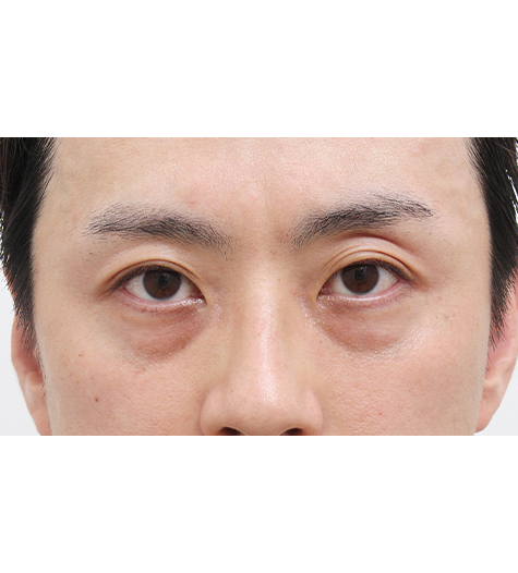 Before Image