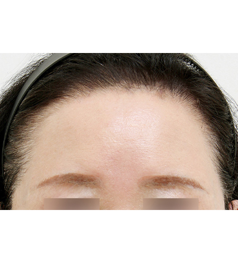 Before Image