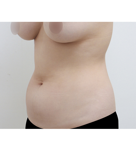 Before Image 3