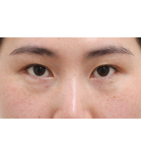 Before Image