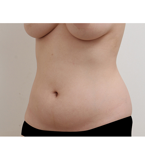 Before Image 3
