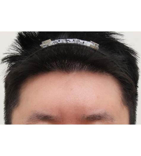 Before Image