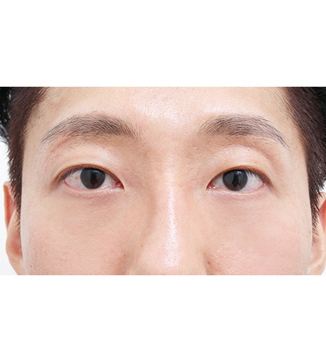 Before Image