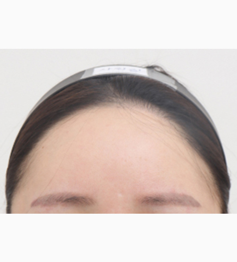 Before Image