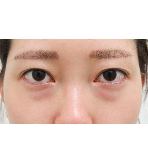 Before Image