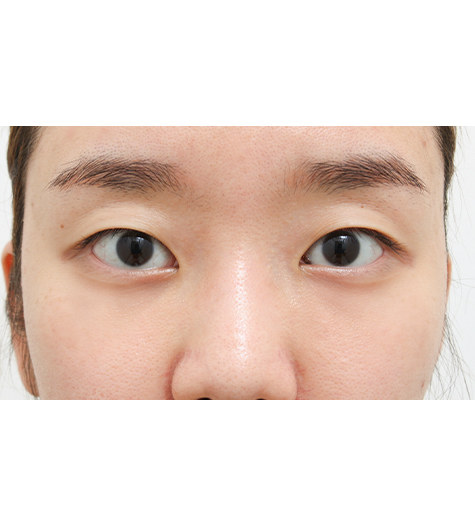 Before Image