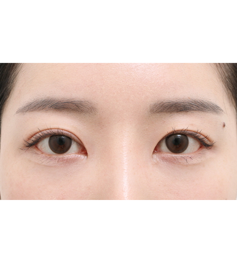 Before Image
