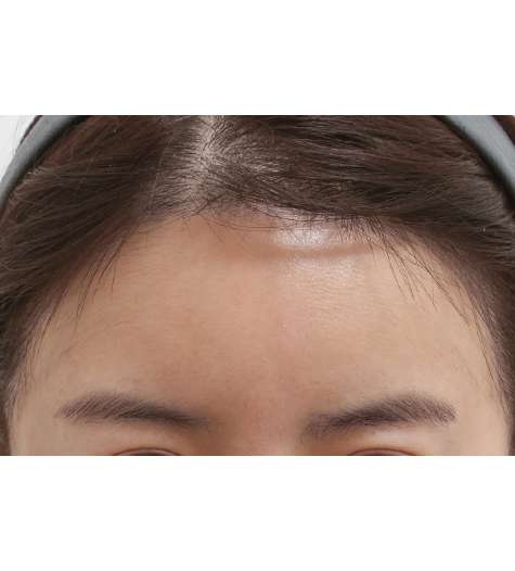 Before Image