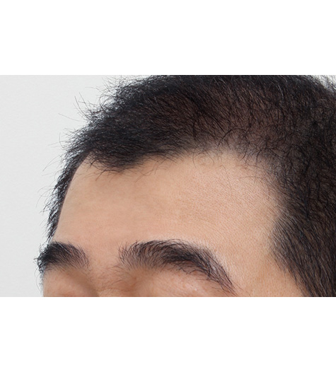 Before Image 4
