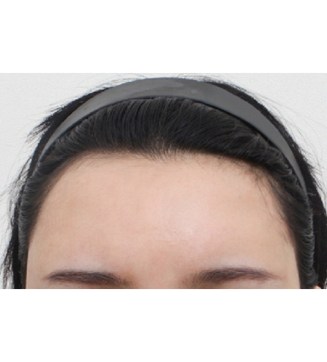 Before Image 3