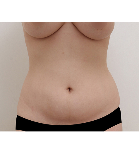Before Image