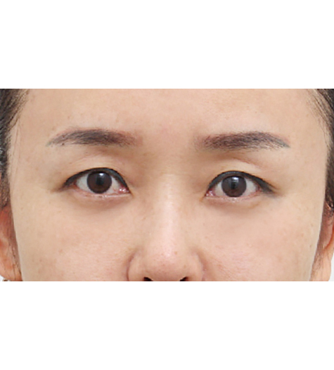 Before Image