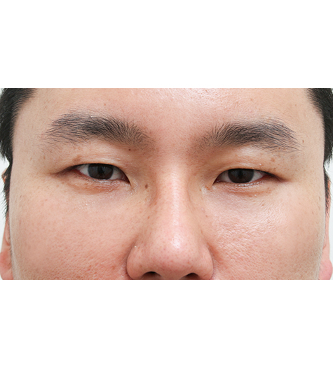 Before Image
