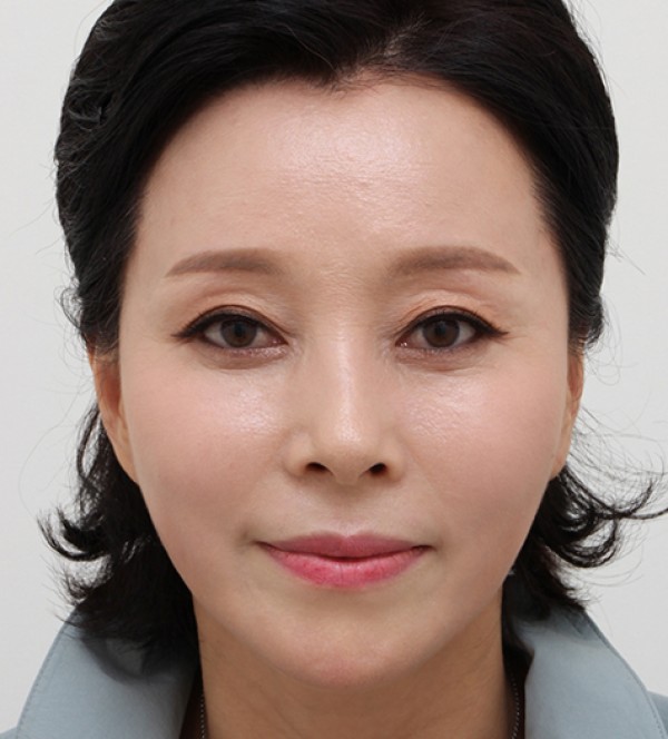迷你拉皮
