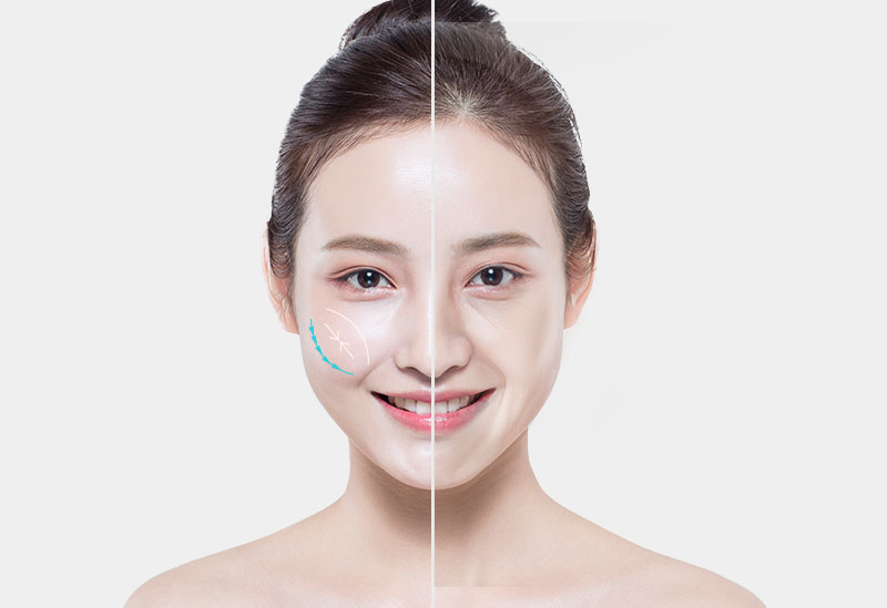 모델