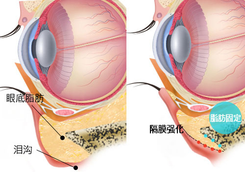모델