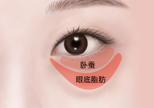 모델