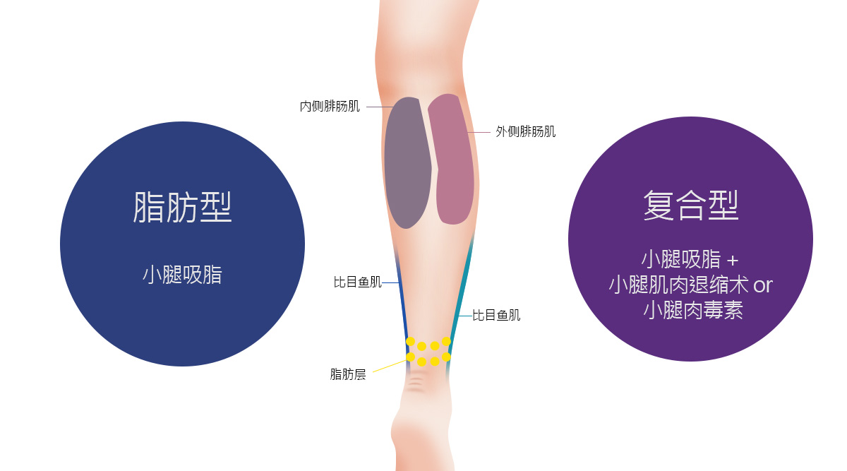 모델