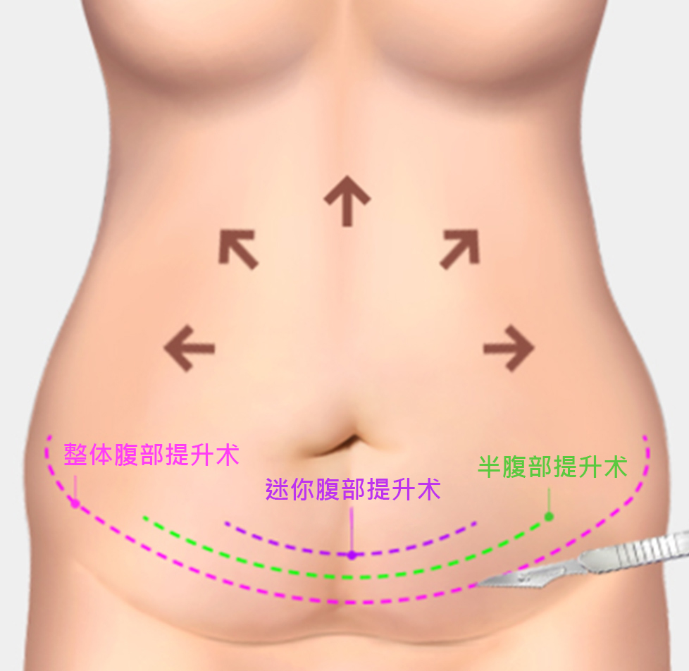 모델
