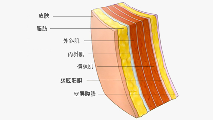 모델