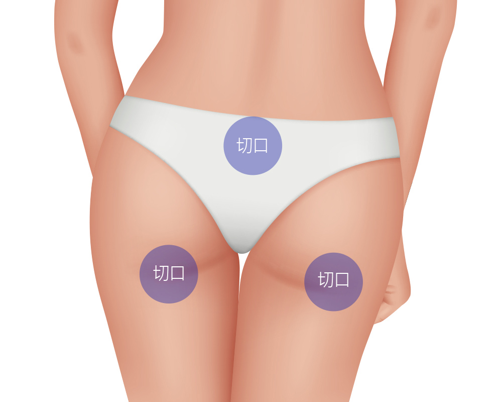 모델