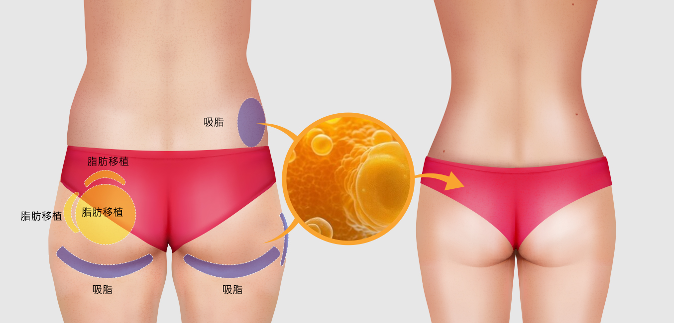 모델