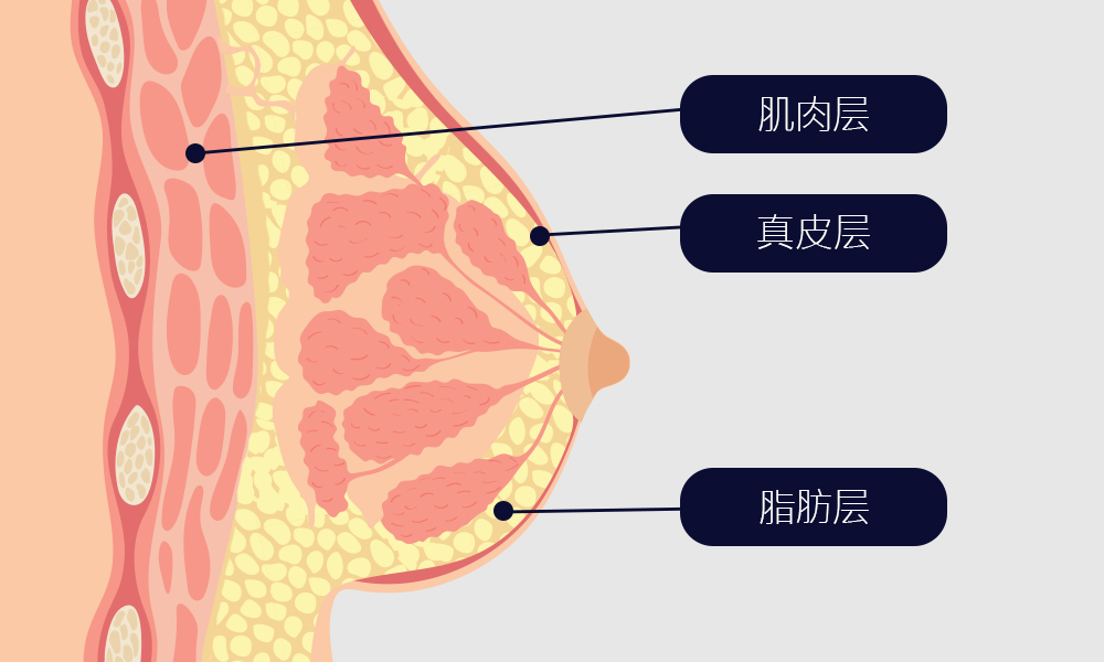 모델