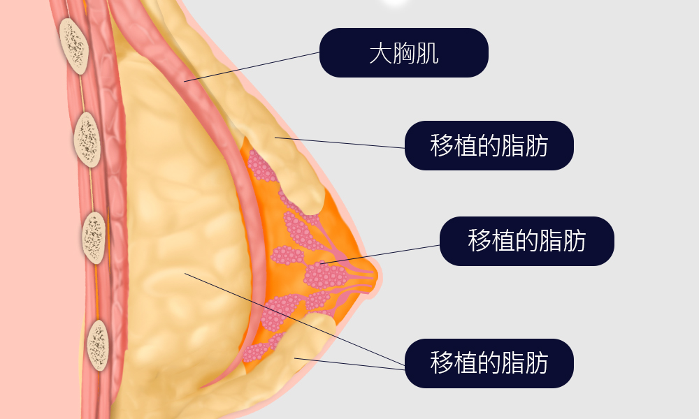 모델