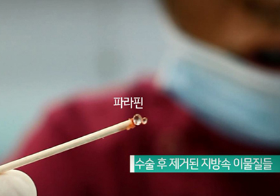 모델