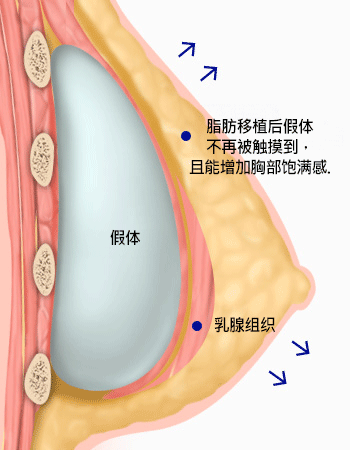 모델