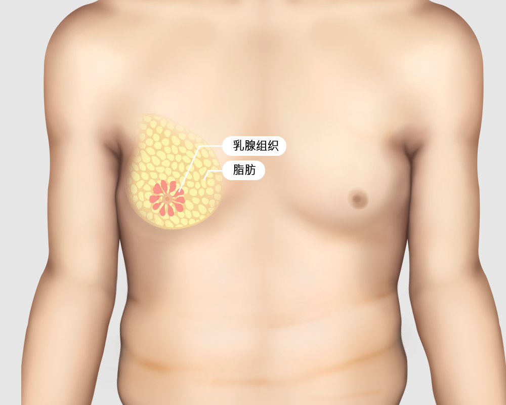 모델