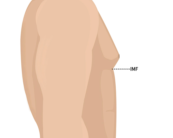 모델