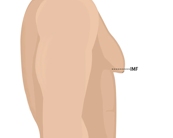 모델