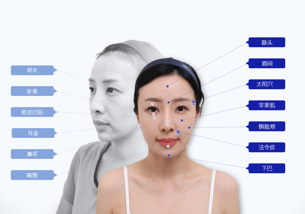 모델