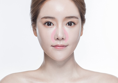 모델
