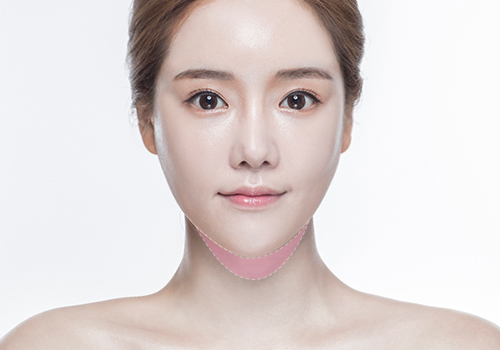 모델